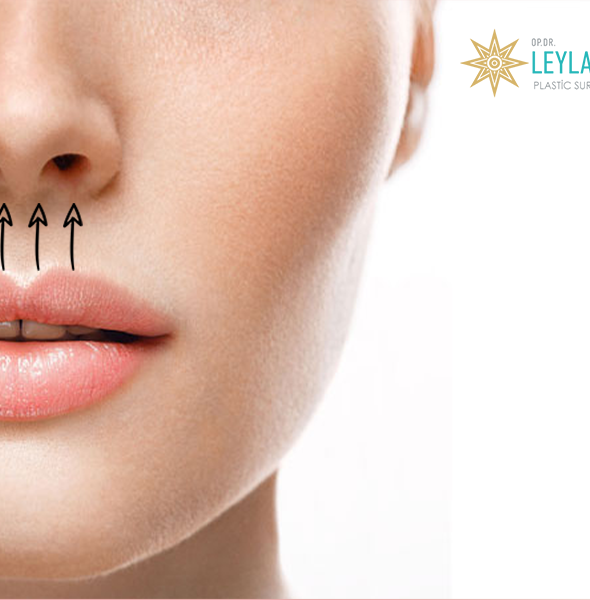 Lip Lift