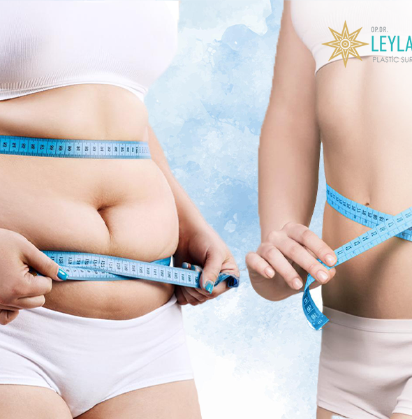 Liposuction İle Kaç Kilo Yağ Alınır