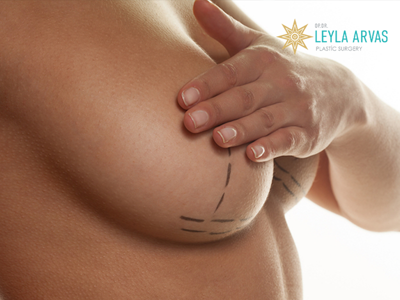 Nipple Reduction 2 Nipple Reduction
