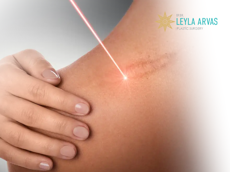 Scar Revision Surgery Transforming the Appearance of Scars