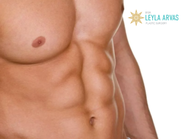 Abdominoplasty For Men (Tummy Tuck) 1 Abdominoplasty For Men (Tummy Tuck)