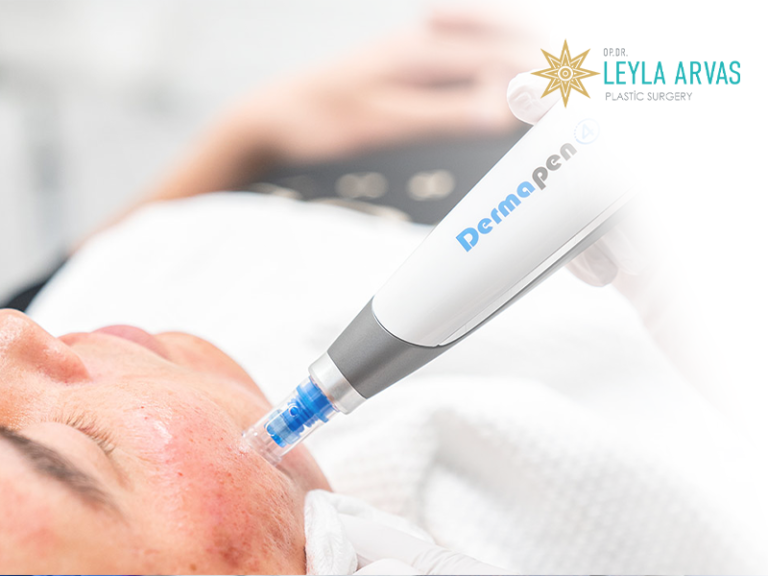 Dermapen Revitalize Your Skin Op. Dr. Leyla