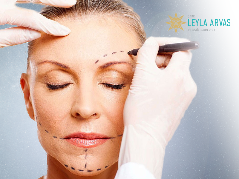 Face Lift (Rhytidectomy) 2 Face Lift (Rhytidectomy)