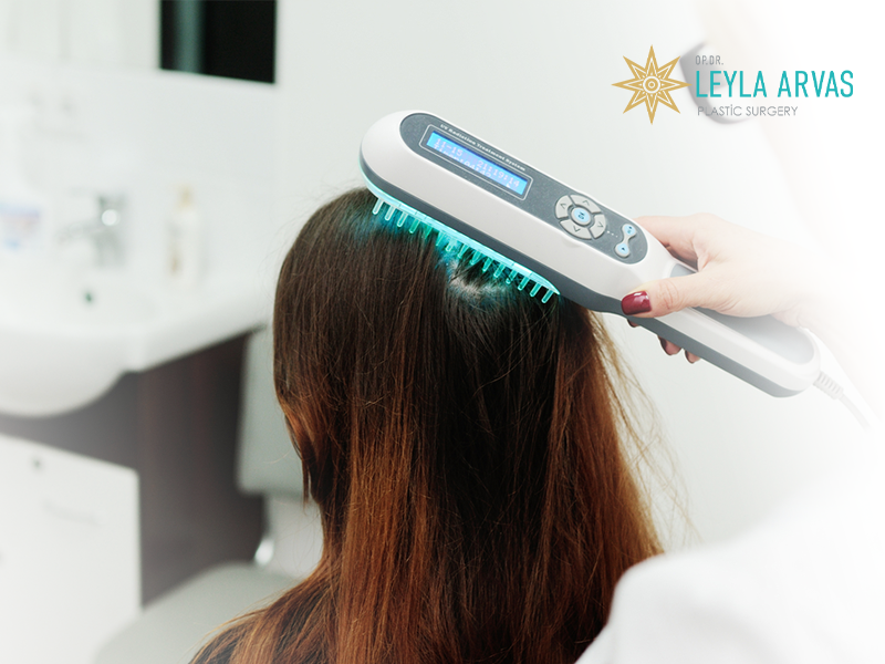 Laser Treatment for Hair Loss