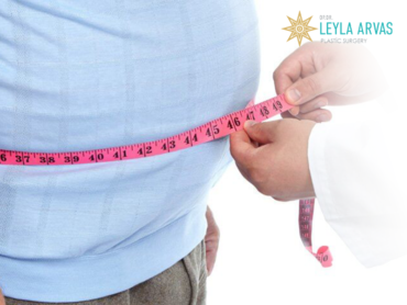Post Bariatric Surgery 1 Post Bariatrik Cerrahi