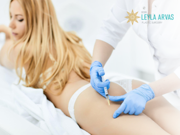Fat Injection to Buttocks 1 Popoya Yağ Enjeksiyonu