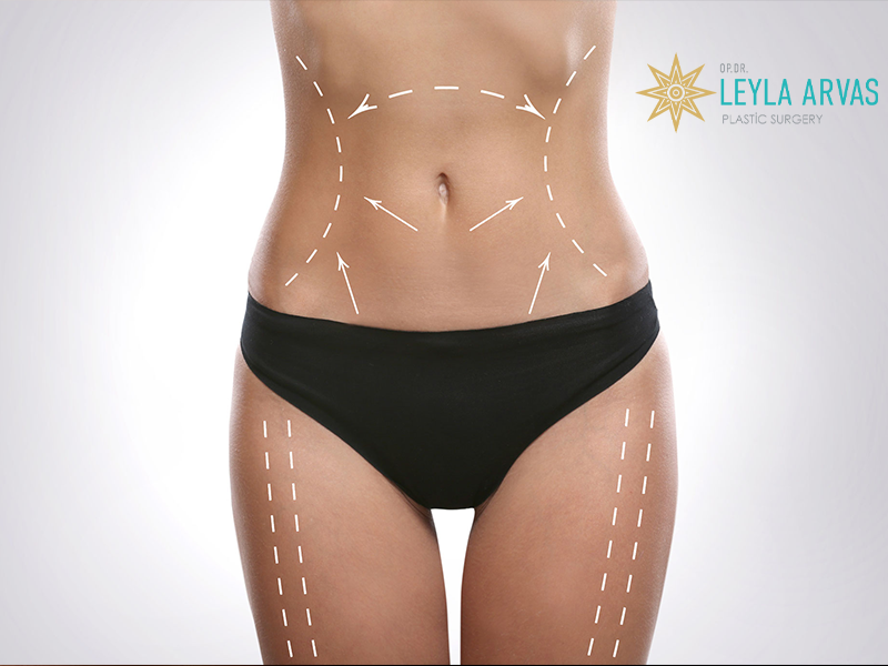 Laser Fat Reduction (SculpSure) Laser Fat Removal
