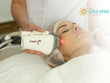 Fractional Laser 1 Fraksiyonel Lazer