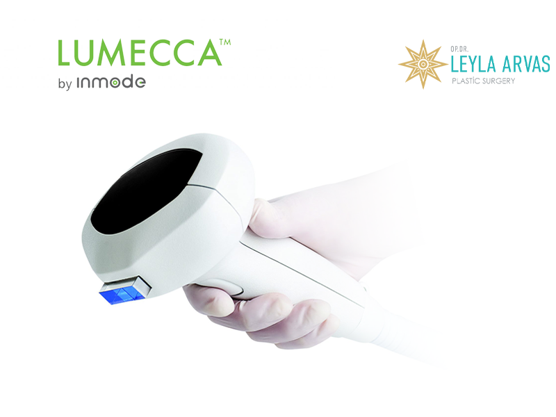 Lumecca IPL Laser 2 Lumecca IPL Laser Treatment